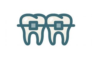 Dental Braces