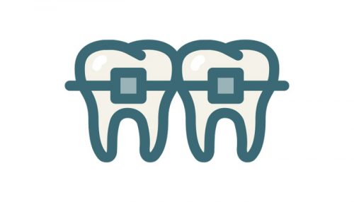 Dental Braces