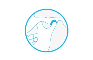 Dental TMJ/TMD
