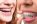 Braces & Invisalign
