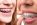 Braces & Invisalign