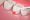 What is Laser Dentistry?