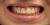 Braces & Invisalign®