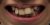 Braces & Invisalign®