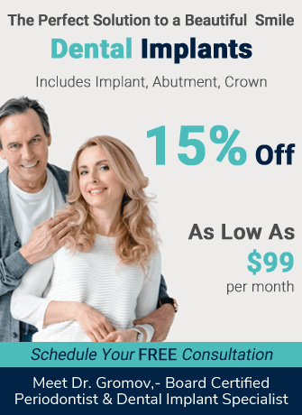 15% off on Dental Implants