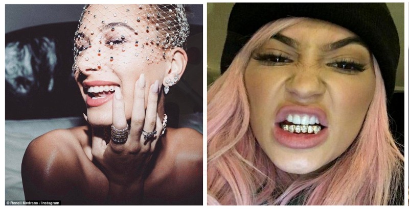 What’s the secret behind the glittering smile of Kylie Jenner, Hailey Baldwin, or Katy Perry?