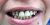 Implant-13 Before