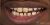 Veneer-16 Before