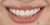 Smile Makeover-03 After