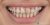 Smile Makeover-03 Before