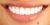Smile Makeover-04 After