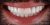 Smile Makeover-05 After