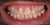Smile Makeover-05 Before
