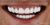 Smile Makeover-07 After