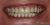 Smile Makeover-09 After