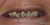 Smile Makeover-10 Before