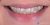 Smile Makeover-11 Before