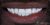 Smile Makeover-12 After