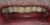 Smile Makeover-13 After
