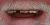 Smile Makeover-13 Before