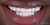 Smile Makeover-15 After