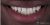 Smile Makeover-15 Before