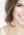 What are the Best Options for Fast Teeth Whitening?