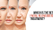 Aging Gracefully: Integrating Botox and Fillers into Comprehensive Dental Care